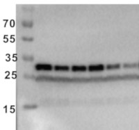 RPS6A-P237 | Phosphorylated (Ser237) 40S ribosomal protein S6-1 in the group Antibodies Plant/Algal / DNA/RNA/Cell Cycle / Translation at Agrisera AB (Antibodies for research) (AS19 4291)